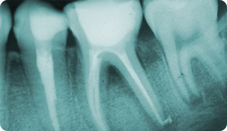 Ortodoncia, brackets convecionales, estéticos y ortodoncia invisible